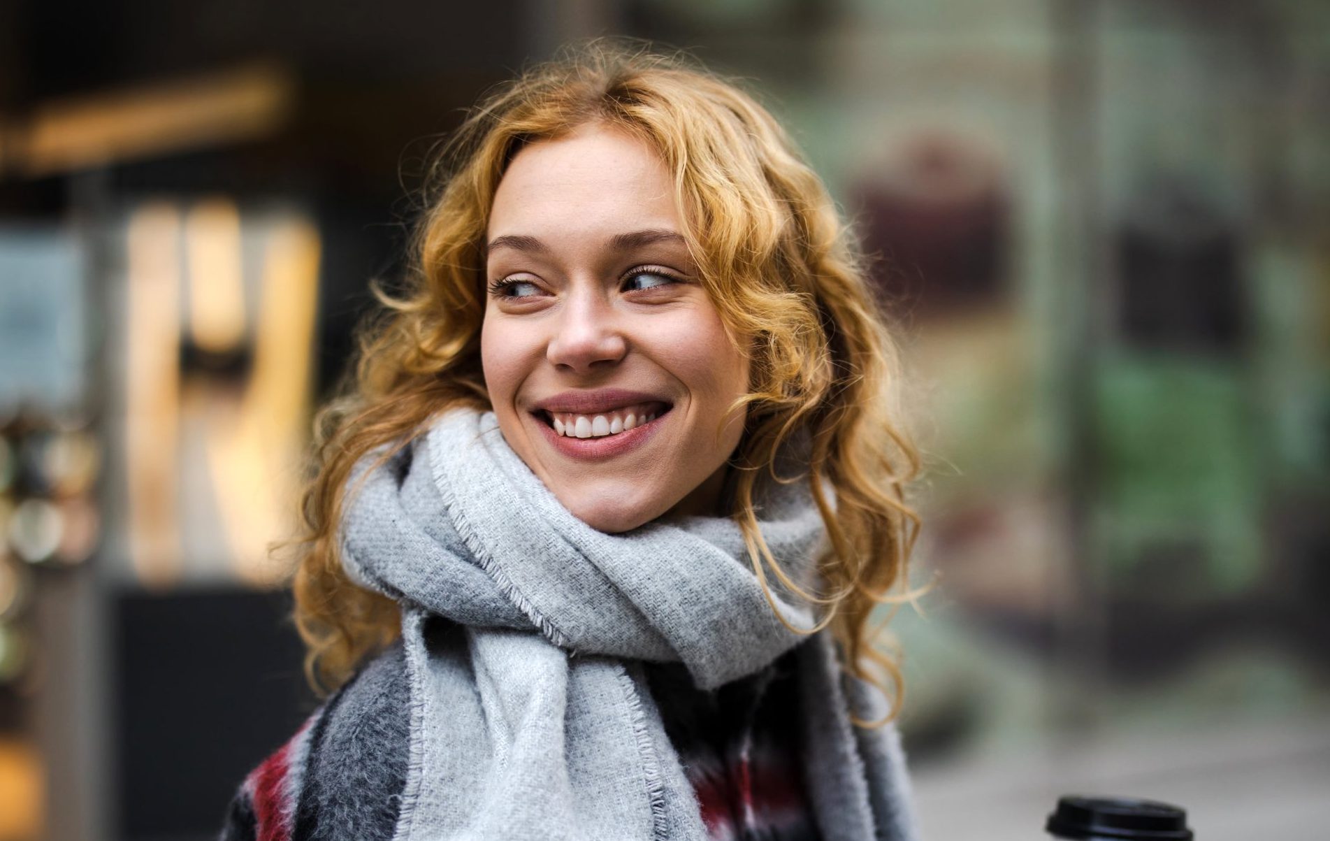 Invisalign2-min Veneers patient at Smile Haven in St Charles IL