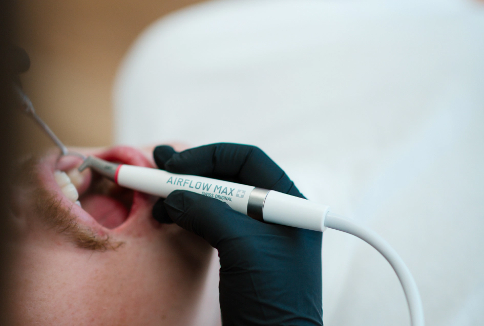 custom crowns & bridges from Smile Haven Dental Studio in St Charles IL