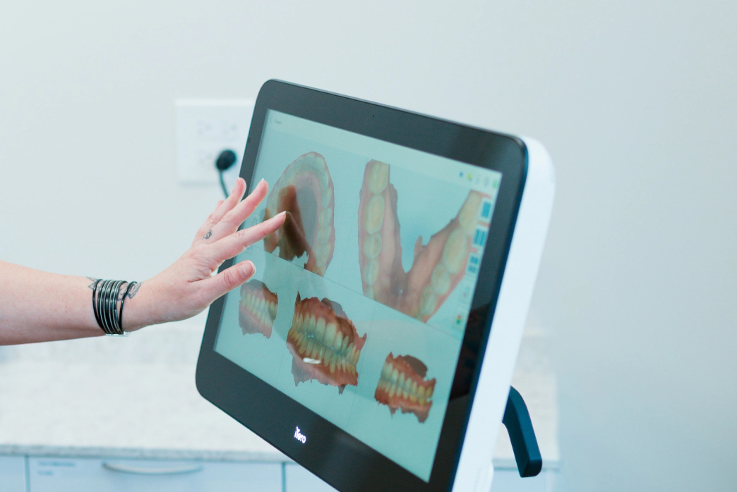 Fluoride treatment from Smile Haven Dental Studio in St Charles IL