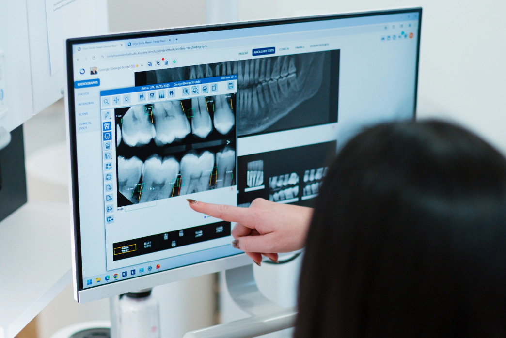 patients smiling after her oral cancer screenings from Smile Haven Dental Studio in St Charles IL