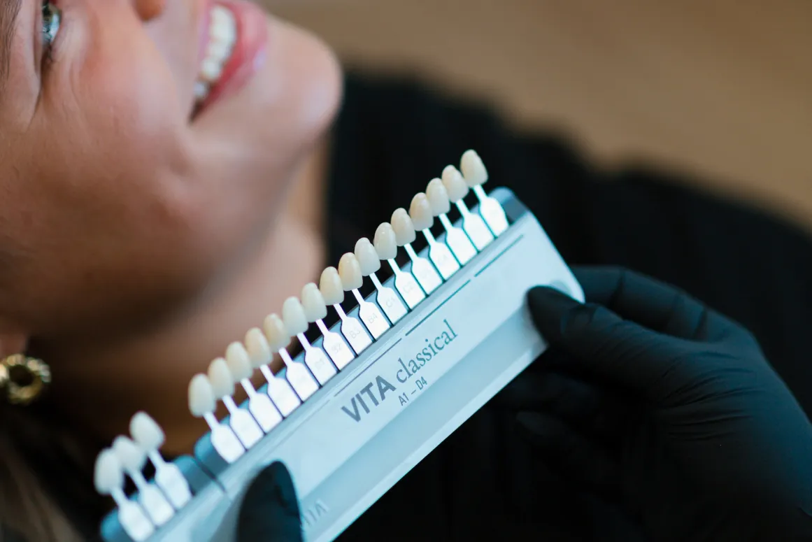 tooth fillings from Smile Haven Dental Studio in St Charles IL