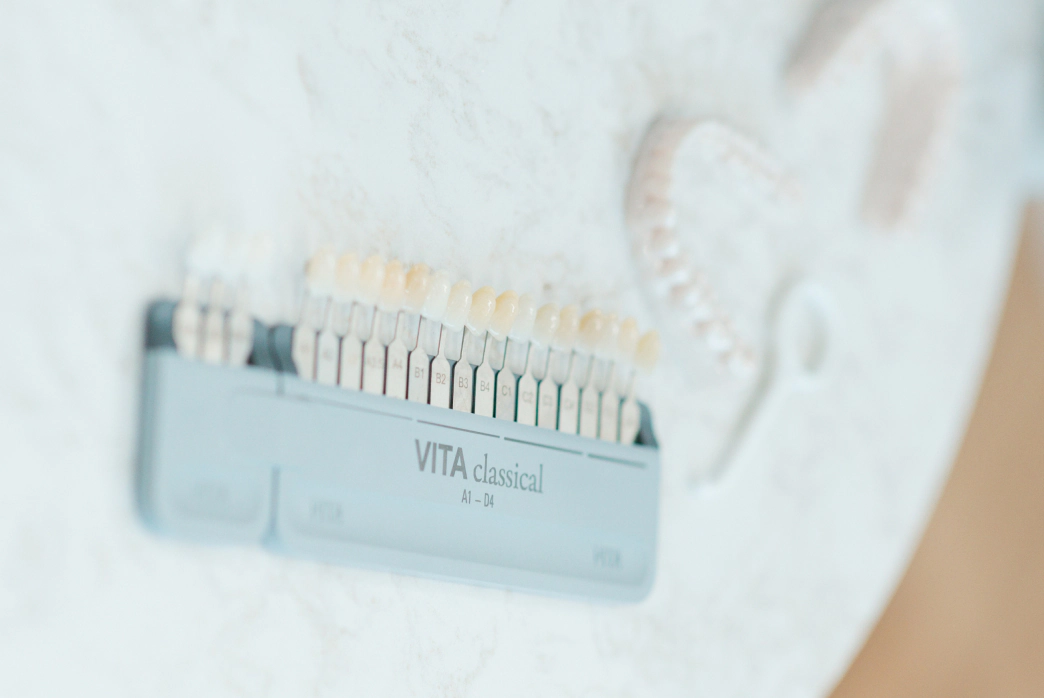 Veneers patient at Smile Haven in St Charles IL